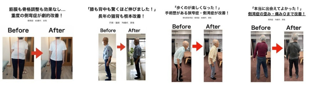 施術例