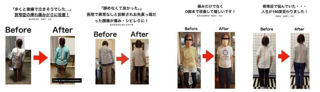 施術例