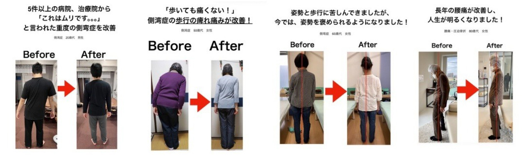 施術例